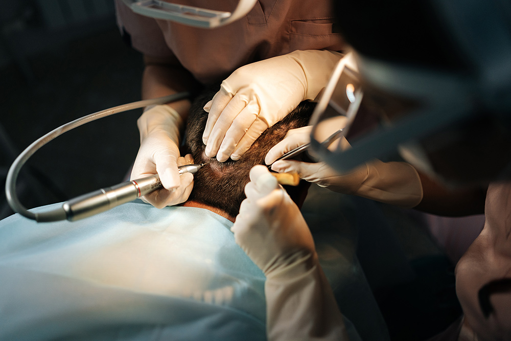 FUE vs FUT Success Rate | FUE vs FUT Hair Transplant | FUE or FUT