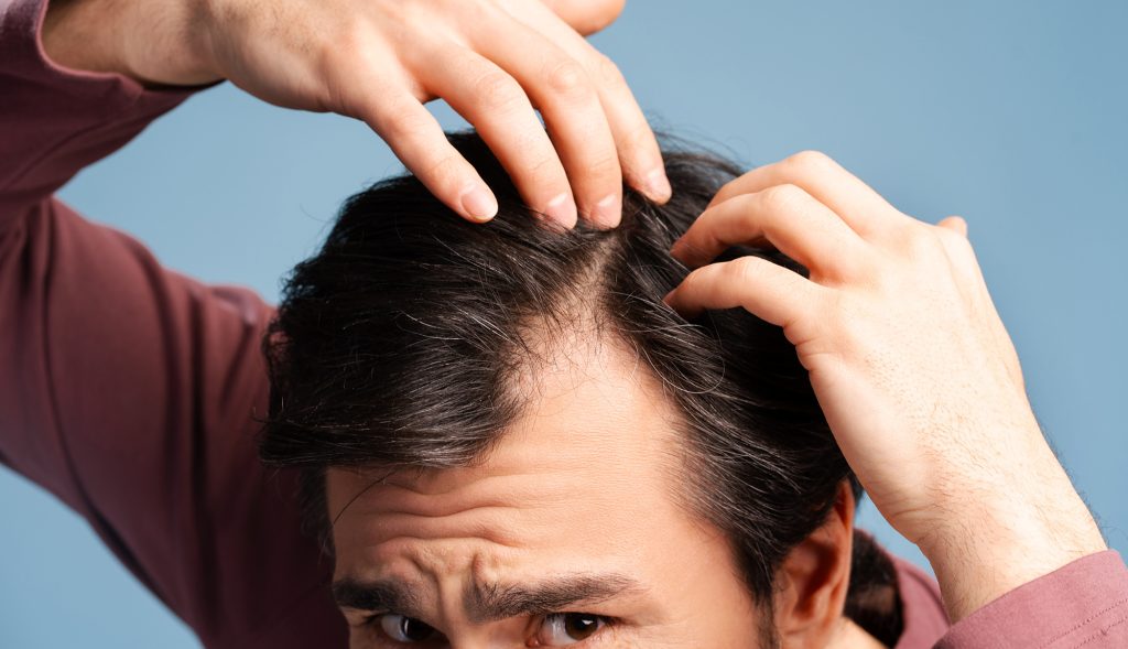 why is my hair falling out why is my hair falling out suddenly hair falling out causes why am I losing hair